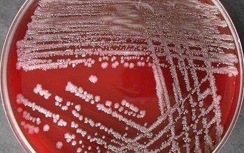 Rothia mucilaginosa Blood Agar 48h culture incubated with CO2