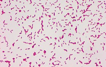 Salmonella manhattan (Salmonella enterica subsp. enterica serovar Manhattan) Gram stain