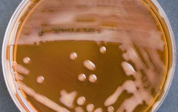 Salmonella manhattan (Salmonella enterica subsp. enterica serovar Manhattan) Mac Conkey Agar without salt 24h culture incubated with O2