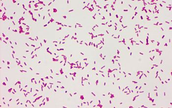 Salmonella manhattan (Salmonella enterica subsp. enterica serovar Manhattan) Gram stain