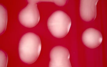 Salmonella manhattan (Salmonella enterica subsp. enterica serovar Manhattan) Blood Agar 24h culture incubated with O2
