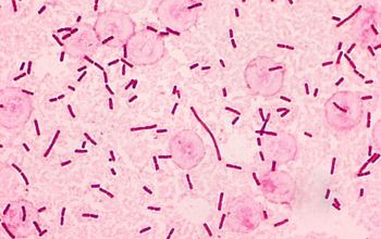 Salmonella typhi (Salmonella enterica subsp. enterica serovar Typhi) Gram stain