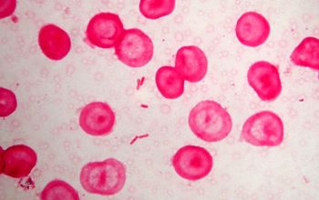 Salmonella typhi (Salmonella enterica subsp. enterica serovar Typhi) Gram stain