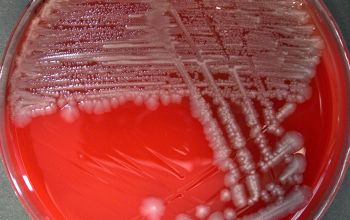 Salmonella typhimurium (Salmonella enterica subsp. enterica serovar Typhimurium) Blood Agar 24h culture incubated with O2