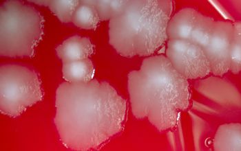 Salmonella typhimurium (Salmonella enterica subsp. enterica serovar Typhimurium) Blood Agar 24h culture incubated with O2