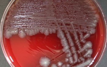 Salmonella typhimurium (Salmonella enterica subsp. enterica serovar Typhimurium) Blood Agar 48h culture incubated with O2