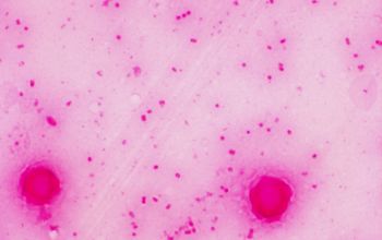 Salmonella typhimurium (Salmonella enterica subsp. enterica serovar Typhimurium) Gram stain