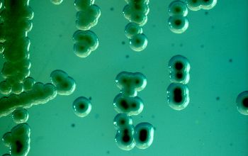 Salmonella typhimurium (Salmonella enterica subsp. enterica serovar Typhimurium)  culture incubated with O2