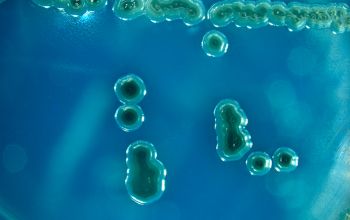 Salmonella typhimurium (Salmonella enterica subsp. enterica serovar Typhimurium)  culture incubated with O2