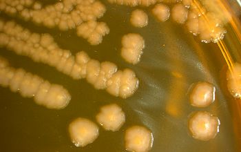 Salmonella typhimurium (Salmonella enterica subsp. enterica serovar Typhimurium) Mac Conkey Agar without salt 48h culture incubated with O2