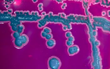 Salmonella typhimurium (Salmonella enterica subsp. enterica serovar Typhimurium)  culture incubated with O2