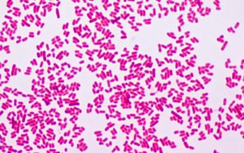 Salmonella typhimurium (Salmonella enterica subsp. enterica serovar Typhimurium) Gram stain