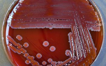 Serratia marcescens Blood Agar 48h culture incubated with O2