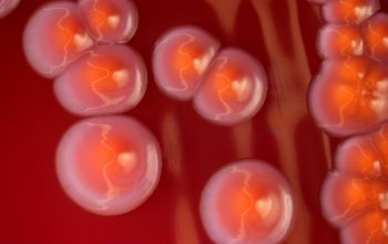 Serratia marcescens Blood Agar 48h culture incubated with O2