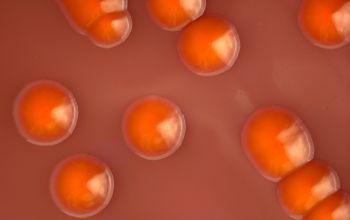 Serratia marcescens Chocolate Agar 24h culture incubated with CO2