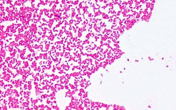 Serratia marcescens Gram stain