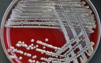 Serratia marcescens Blood Agar 24h culture incubated with O2