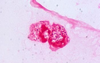 Serratia marcescens Gram stain