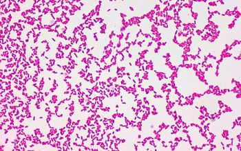 Serratia rubidaea Gram stain