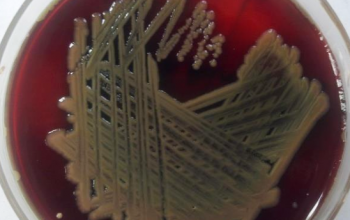 Shewanella algae Blood Agar 48h culture incubated with CO2