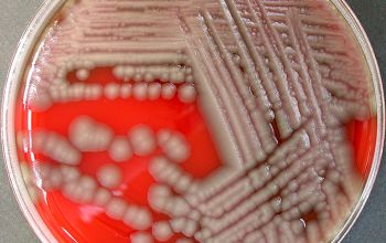 Shewanella putrefaciens Blood Agar 24h culture incubated with CO2