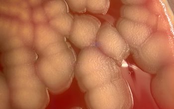 Shewanella putrefaciens Blood Agar 48h culture incubated with O2