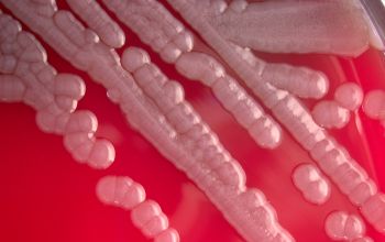 Shewanella putrefaciens Blood Agar 24h culture incubated with CO2