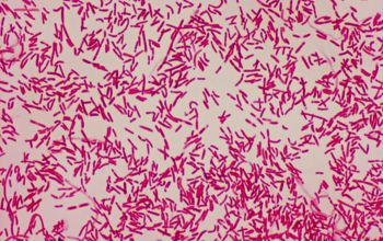 Shewanella putrefaciens Gram stain