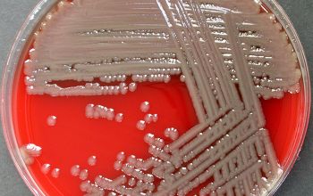 Shewanella putrefaciens Blood Agar 24h culture incubated with O2