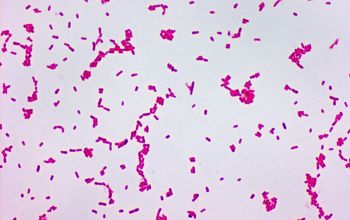 Shigella flexneri Gram stain