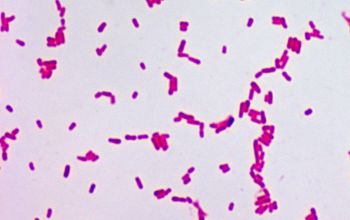 Shigella flexneri Gram stain