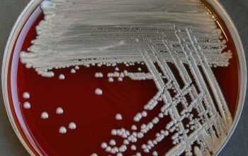 Sphingobacterium multivorum Blood Agar 48h culture incubated with O2