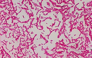 Sphingobacterium multivorum Gram stain