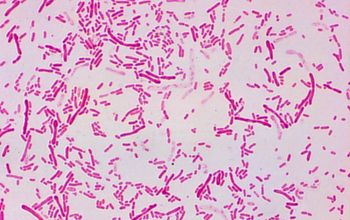 Sphingobacterium multivorum 