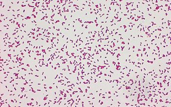 Sphingobacterium spiritivorum Gram stain