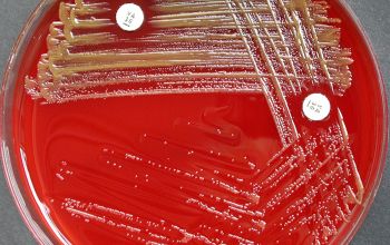 Sphingomonas paucimobilis Blood Agar 24h culture 