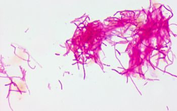 Sphingomonas paucimobilis Gram stain