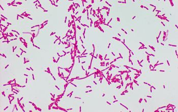 Sphingomonas paucimobilis Gram stain