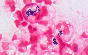 Staphylococcus aureus Gram stain
