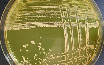 Staphylococcus aureus  culture incubated with O2