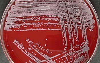 Staphylococcus capitis subsp capitis Blood Agar 24h culture incubated with CO2