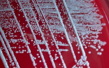 Staphylococcus caprae Blood Agar 24h culture incubated with CO2