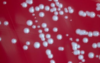 Staphylococcus caprae Blood Agar 24h culture incubated with CO2