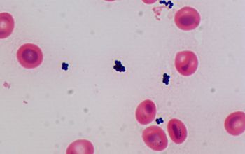 Staphylococcus cohnii subsp cohnii Gram stain