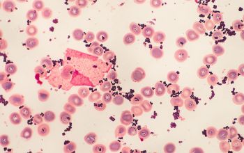 Staphylococcus epidermidis Gram stain