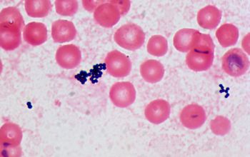 Staphylococcus epidermidis Gram stain