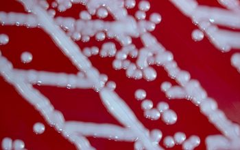 Staphylococcus epidermidis Blood Agar 24h culture incubated with CO2