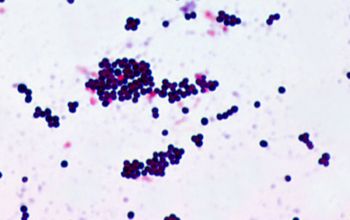 Staphylococcus gallinarum Gram stain