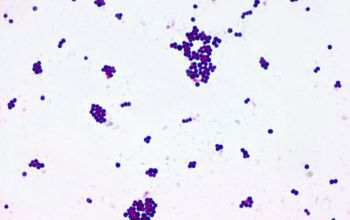 Staphylococcus gallinarum Gram stain