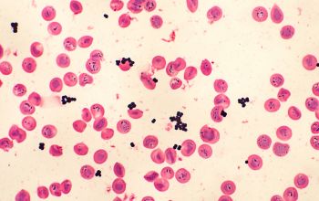 Staphylococcus haemolyticus Gram stain